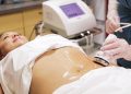 Ultrasound cavitation